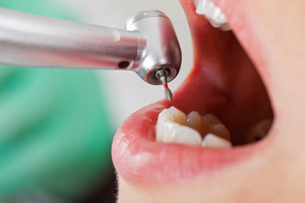 Best Knocked-Out Tooth Emergency  in Castle Hills, TX